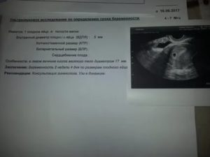 Может ли вагинальное узи не показать беременность на ранних сроках