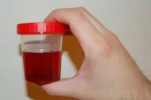Что если при месячных моча коричневая