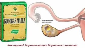 Можно ли принимать мумие при кисте яичника