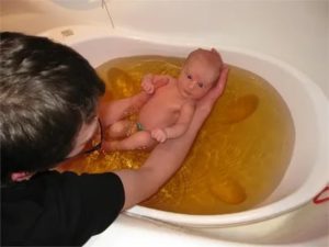 Можно ли купаться в ванной с ребенком при молочнице