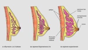 Может ли перед месячными одна грудь быть больше другой