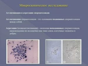 Препараты для лечения агглютинации сперматозоидов