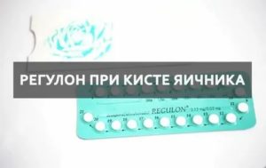 Какие противозачаточные таблетки лучше принимать при кисте на яичнике