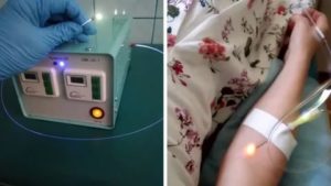 Уфо крови при кандидозе