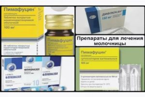 Лечение молочницы при эко