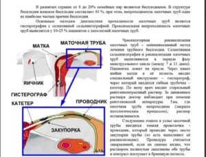 На какой день цикла можно делать узи маточных труб