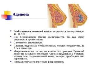 Аденома молочной железы препараты для лечения