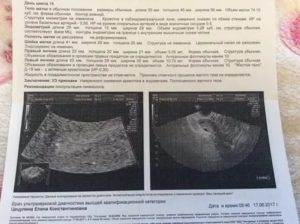 Эндометрий 4 2. УЗИ небеременной матки. Эндометрий матки при беременности. Шейка матки УЗИ структура неоднородная. ВМК В полости матки на УЗИ.
