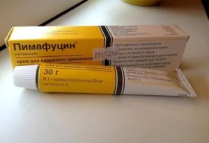 Кетодин крем от молочницы отзывы
