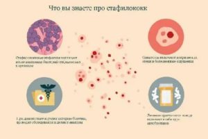 Что это staphylococcus saprophyticus в секрете простаты