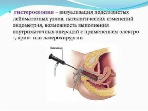 Гистероскопия мва эндометрия что это