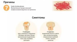 Как по научному называется молочница у женщин