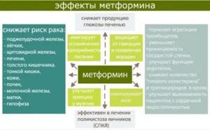 Для чего назначают метформин при поликистозе яичников