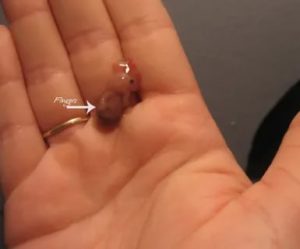 Могут ли начаться месячные при замершей беременности