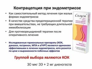 Как правильно подобрать кок при эндометриозе