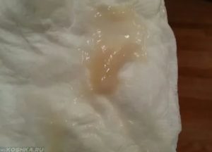 Выделения из влагалища при приеме дюфастона