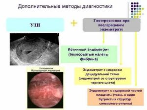 Гистероскопия хронический эндометрит отзывы