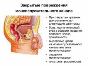 Почему при эрекции выделяется кровь