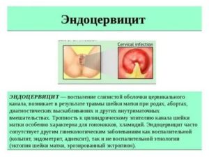 Лечение эндоцервицита при климаксе