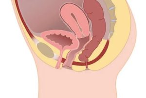 Может ли матка давить на мочевой пузырь при месячных