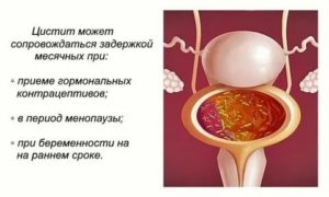 Может ли быть задержка месячных после лечения цистита