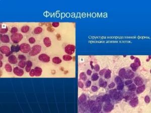 Цитология молочной железы измененные эритроциты