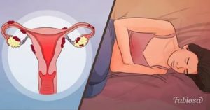 Что может быть за нарушение менструального цикла у девушек