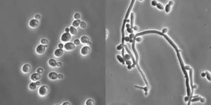 Мукоза при кандидозе