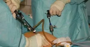 Когда можно кушать после операции киста яичника