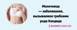 Молочница на грудных железах отзывы
