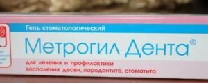 Метрогил дента при кандидозе полости рта