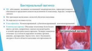 Какой антибиотик принять от выделений во влагалище