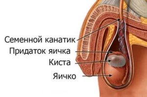 Какого размера может быть киста семенного канатика у ребенка