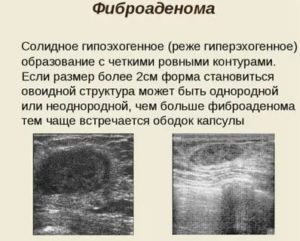 Витамины при фиброаденоме молочных желез