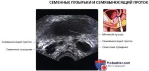 Узи семенных пузырьков как делается