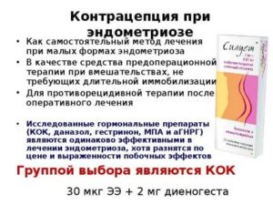 Как правильно подобрать кок при эндометриозе
