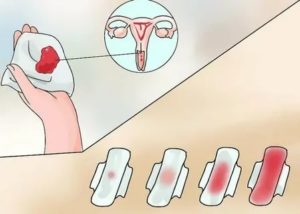 Могут ли месячные задержаться из-за уколов