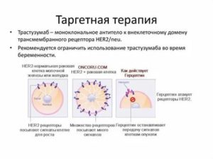 Таргетная терапия при раке молочной железы препараты какой лучше