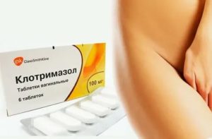 Лечение молочницы перед родами клотримазолом