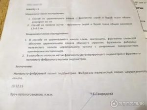 Результаты гистологии после гистероскопии полипа эндометрия