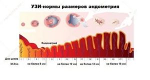 Как быстро нарастает эндометрий после месячных