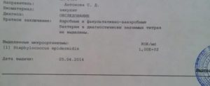 Правила сбора эякулята на посев