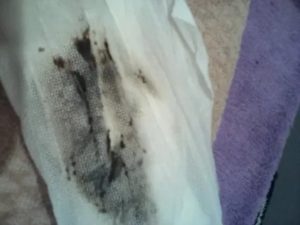 Что может означать когда перед месячными черные выделения