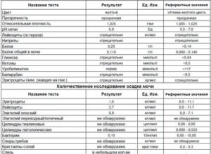 Может ли повышаться белок в моче перед месячными