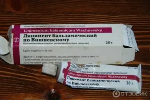 Лечение хронического аднексита мазью вишневского