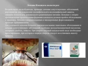 Лечение кандидоза зоба