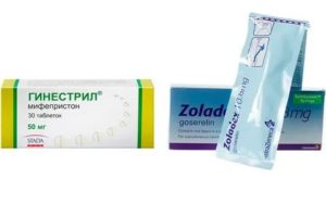 Препарат мифепристон в лечении миомы матки