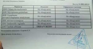 Молочница как определить по анализу мазка