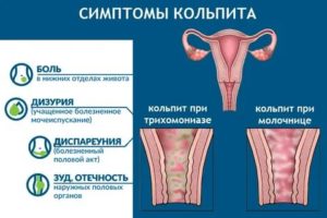 Цитология шейки матки кольпит