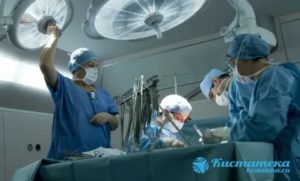 Сколько длится операция по удалению кисты на семенном канатике